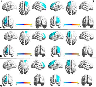 Anatomical Connectivity-Based Strategy for Targeting Transcranial Magnetic Stimulation as Antidepressant Therapy